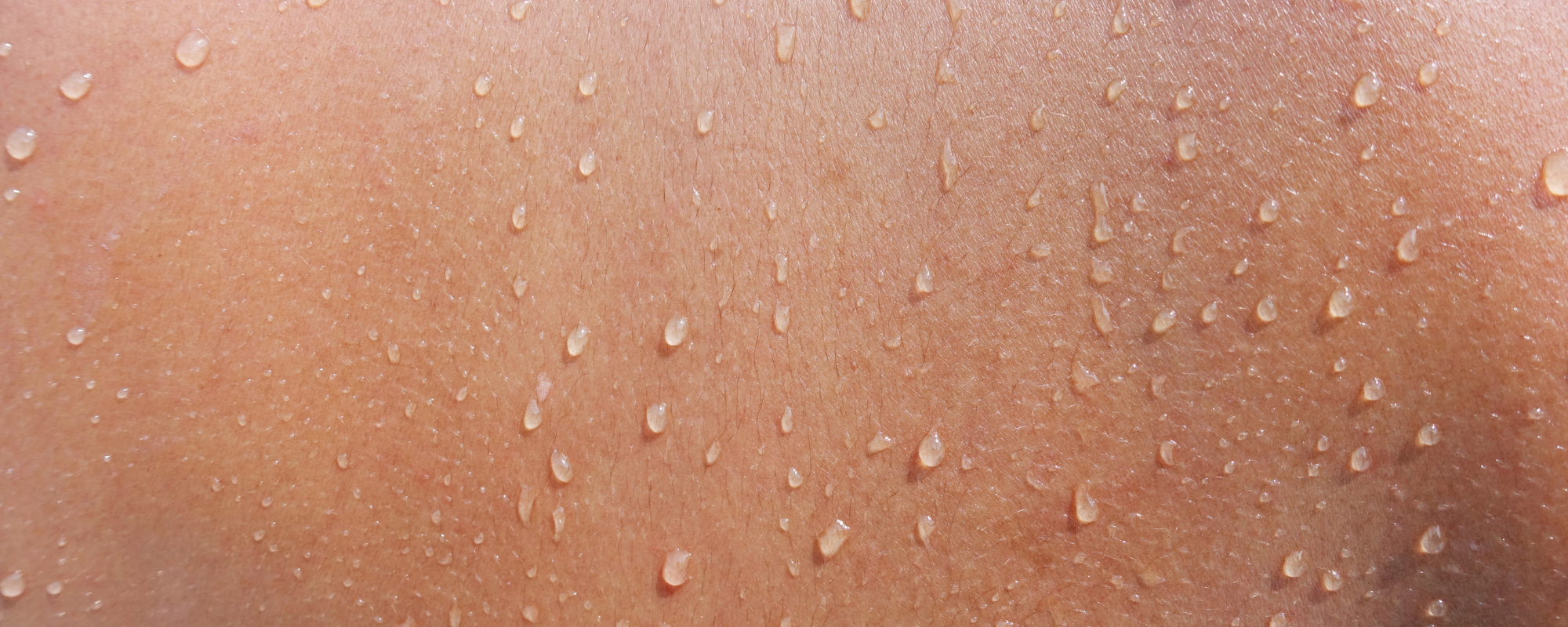 A close-up picture of skin with water droplets